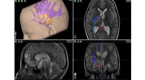 Neuron Vigation