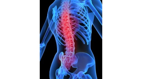 Cervical Spine Surgery